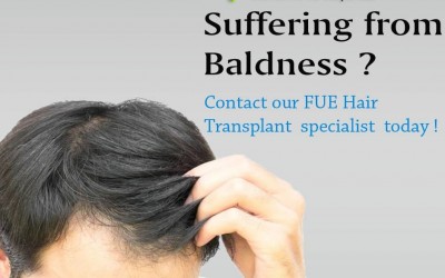 fue hair transplant in Meerut